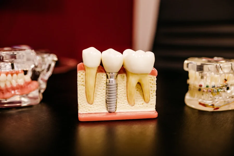 Dental implant titanium fixture